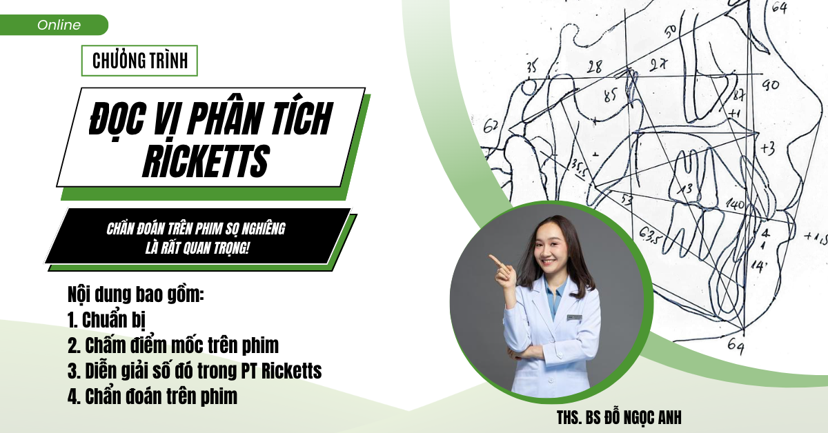 Đọc vị phân tích Ricketts
